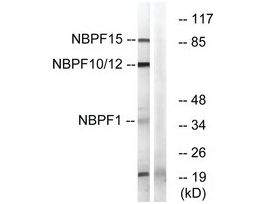Anti-NBPF1, C-Terminal antibody produced in rabbit~1 mg/mL, affinity isolated antibody, buffered aqueous solution