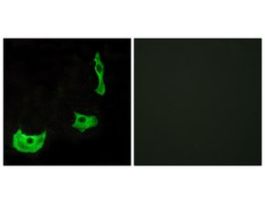 Anti-GPR17 antibody produced in rabbit~1 mg/mL, affinity isolated antibody, buffered aqueous solution