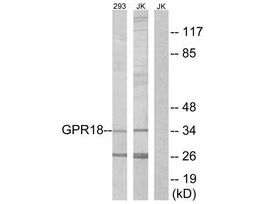 Anti-GPR18 antibody produced in rabbit~1 mg/mL, affinity isolated antibody, buffered aqueous solution