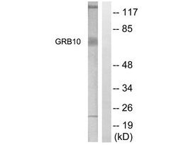 Anti-GRB10, N-Terminal antibody produced in rabbit~1 mg/mL, affinity isolated antibody, buffered aqueous solution