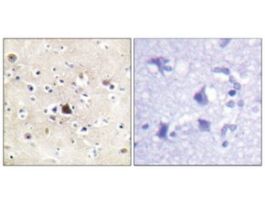 Anti-GR antibody produced in rabbit~1 mg/mL, affinity isolated antibody, buffered aqueous solution