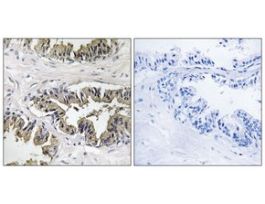 Anti-GSPT1 antibody produced in rabbit~1 mg/mL, affinity isolated antibody, buffered aqueous solution