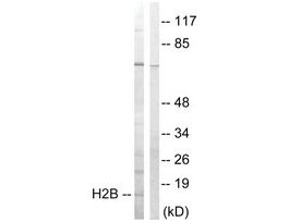 Anti-Histone H2B, N-Terminal antibody produced in rabbit~1 mg/mL, affinity isolated antibody, buffered aqueous solution