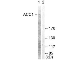Anti-ACC1, N-Terminal antibody produced in rabbit~1 mg/mL, affinity isolated antibody, buffered aqueous solution