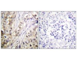 Anti-Survivin antibody produced in rabbit~1 mg/mL, affinity isolated antibody, buffered aqueous solution