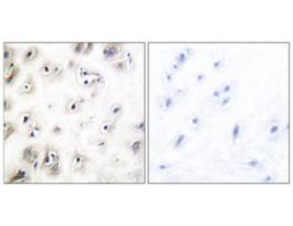 Anti-Amylin, N-Terminal antibody produced in rabbit~1 mg/mL, affinity isolated antibody, buffered aqueous solution