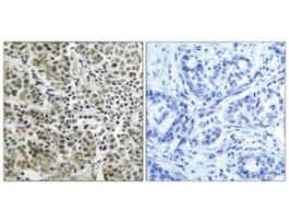 Anti-Androgen Receptor antibody produced in rabbit~1 mg/mL, affinity isolated antibody, buffered aqueous solution