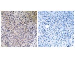 Anti-NDUFS7, C-Terminal antibody produced in rabbit~1 mg/mL, affinity isolated antibody, buffered aqueous solution