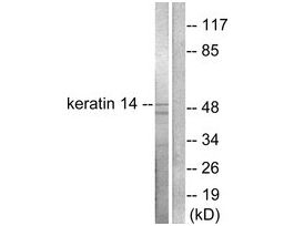 Anti-Keratin 14, N-Terminal antibody produced in rabbit~1 mg/mL, affinity isolated antibody, buffered aqueous solution