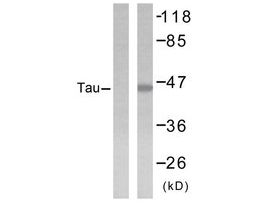Anti-TAU, C-Terminal antibody produced in rabbit~1 mg/mL, affinity isolated antibody, buffered aqueous solution