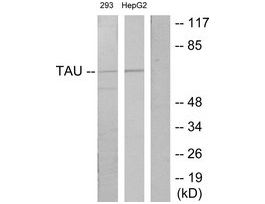 Anti-TAU antibody produced in rabbit~1 mg/mL, affinity isolated antibody, buffered aqueous solution