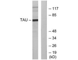 Anti-TAU, C-Terminal antibody produced in rabbit~1 mg/mL, affinity isolated antibody, buffered aqueous solution