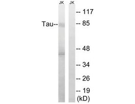 Anti-TAU antibody produced in rabbit~1 mg/mL, affinity isolated antibody, buffered aqueous solution