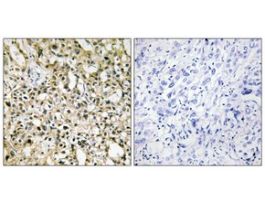 Anti-MYC, C-Terminal antibody produced in rabbit~1 mg/mL, affinity isolated antibody, buffered aqueous solution