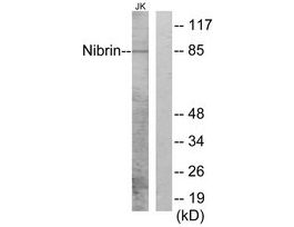 Anti-Nibrin antibody produced in rabbit~1 mg/mL, affinity isolated antibody, buffered aqueous solution
