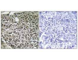 Anti-NFAT3, C-Terminal antibody produced in rabbit~1 mg/mL, affinity isolated antibody, buffered aqueous solution