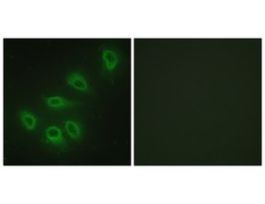 Anti-ENOS, C-Terminal antibody produced in rabbit~1 mg/mL, affinity isolated antibody, buffered aqueous solution
