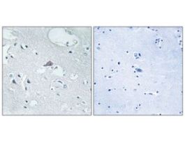 Anti-OPRM1, N-Terminal antibody produced in rabbit~1 mg/mL, affinity isolated antibody, buffered aqueous solution