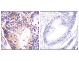 Anti-PAK1 antibody produced in rabbit~1 mg/mL, affinity isolated antibody, buffered aqueous solution
