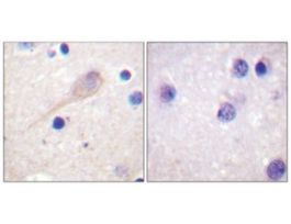 Anti-Parkin antibody produced in rabbit~1 mg/mL, affinity isolated antibody, buffered aqueous solution