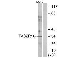 Anti-TAS2R16 antibody produced in rabbit~1 mg/mL, affinity isolated antibody, buffered aqueous solution