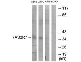 Anti-TAS2R7 antibody produced in rabbit~1 mg/mL, affinity isolated antibody, buffered aqueous solution
