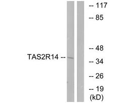 Anti-TAS2R14 antibody produced in rabbit~1 mg/mL, affinity isolated antibody, buffered aqueous solution