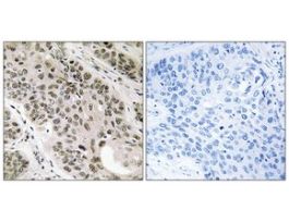 Anti-TNNI3K antibody produced in rabbit~1 mg/mL, affinity isolated antibody, buffered aqueous solution