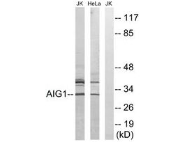Anti-AIG1, C-Terminal antibody produced in rabbit~1 mg/mL, affinity isolated antibody, buffered aqueous solution