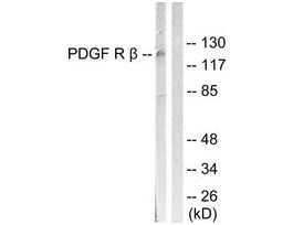 Anti-PDGFR beta, C-Terminal antibody produced in rabbit~1 mg/mL, affinity isolated antibody, buffered aqueous solution