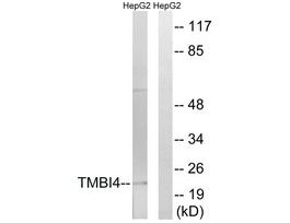 Anti-TMBIM4 antibody produced in rabbit~1 mg/mL, affinity isolated antibody, buffered aqueous solution