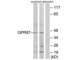 Anti-GPR87 antibody produced in rabbit~1 mg/mL, affinity isolated antibody, buffered aqueous solution