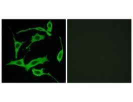 Anti-GPR85 antibody produced in rabbit~1 mg/mL, affinity isolated antibody, buffered aqueous solution