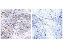 Anti-CLN6, C-Terminal antibody produced in rabbit~1 mg/mL, affinity isolated antibody, buffered aqueous solution