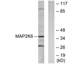 Anti-MAP2K6, N-Terminal antibody produced in rabbit~1 mg/mL, affinity isolated antibody, buffered aqueous solution