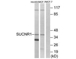 Anti-SUCNR1 antibody produced in rabbit~1 mg/mL, affinity isolated antibody, buffered aqueous solution