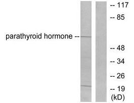 Anti-Parathyroid Hormone antibody produced in rabbit~1 mg/mL, affinity isolated antibody, buffered aqueous solution