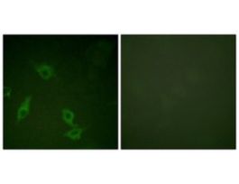 Anti-FAK antibody produced in rabbit~1 mg/mL, affinity isolated antibody, buffered aqueous solution