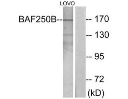 Anti-BAF250B antibody produced in rabbit~1 mg/mL, affinity isolated antibody, buffered aqueous solution