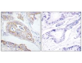 Anti-CD45, C-Terminal antibody produced in rabbit~1 mg/mL, affinity isolated antibody, buffered aqueous solution