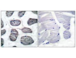Anti-ACTIN-alpha-1, N-Terminal antibody produced in rabbit~1 mg/mL, affinity isolated antibody, buffered aqueous solution