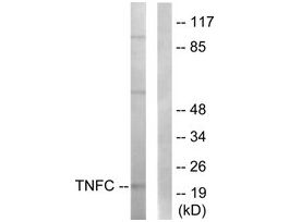 Anti-TNFC, C-Terminal antibody produced in rabbit~1 mg/mL, affinity isolated antibody, buffered aqueous solution