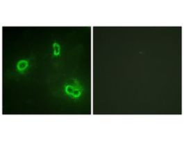 Anti-p90 RSK, C-Terminal antibody produced in rabbit~1 mg/mL, affinity isolated antibody, buffered aqueous solution