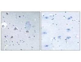 Anti-p70 S6 Kinase antibody produced in rabbit~1 mg/mL, affinity isolated antibody, buffered aqueous solution