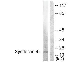 Anti-Syndecan4, C-Terminal antibody produced in rabbit~1 mg/mL, affinity isolated antibody, buffered aqueous solution
