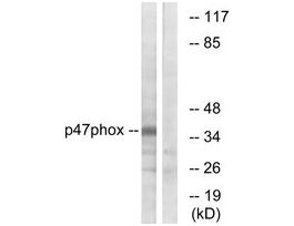 Anti-p47 PHOX, C-Terminal antibody produced in rabbit~1 mg/mL, affinity isolated antibody, buffered aqueous solution