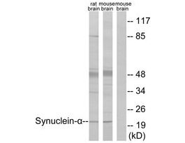 Anti-Synuclein-alpha, C-Terminal antibody produced in rabbit~1 mg/mL, affinity isolated antibody, buffered aqueous solution