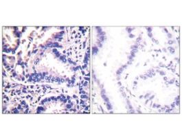 Anti-Synuclein gamma, C-Terminal antibody produced in rabbit~1 mg/mL, affinity isolated antibody, buffered aqueous solution