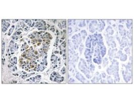 Anti-MTSSB, C-Terminal antibody produced in rabbit~1 mg/mL, affinity isolated antibody, buffered aqueous solution