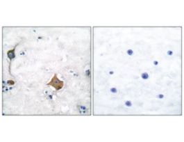 Anti-Synaptophysin antibody produced in rabbit~1 mg/mL, affinity isolated antibody, buffered aqueous solution